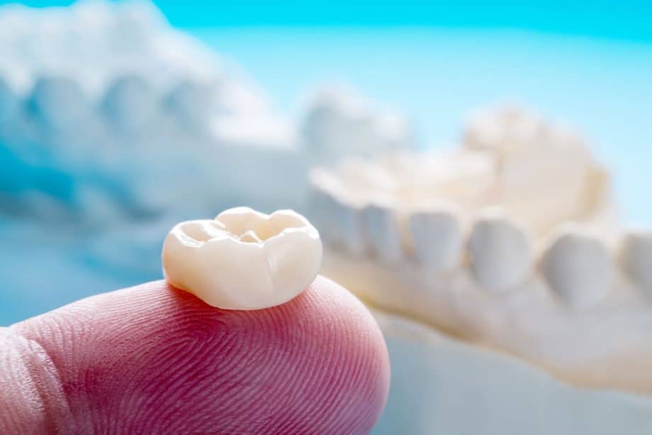  What Are Dental Crowns Made Of?