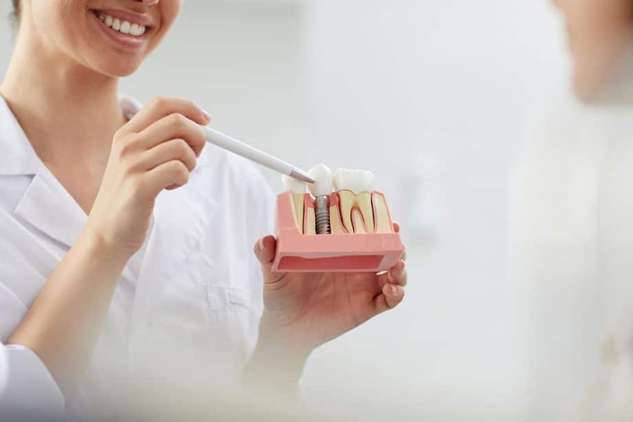 What Are Dental Implants?